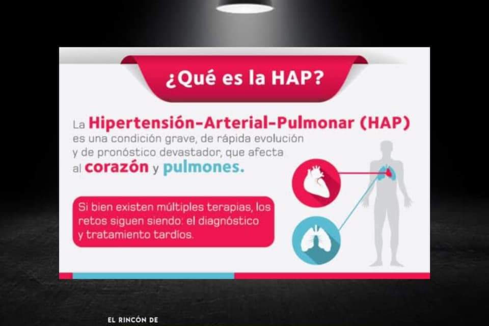 LA HIPERTENSIÓN ARTERIAL SE ESTÁ CONVIRTIENDO EN UNA PREOCUPACIÓN PARA LOS MEXICANOS YA QUE, CADA VEZ ES MÁS COMPLICADA SU DETECCIÓN