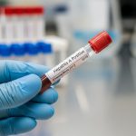 META PARA ELIMINAR LA HEPATITIS SE POSPONE A 2040 ANTE BAJO DIAGNÓSTICO Y PREVENCIÓN